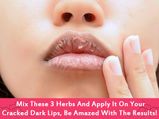 Mix These 3 Herbs & Apply It On Your Cracked Dark Lips, Be Amazed With The Results!