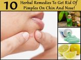 10 Herbal Remedies To Get Rid Of Pimples On The Chin & Nose!