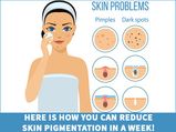 Here Is How You Can Reduce Skin Pigmentation In A Week!