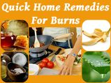 Burnt Your Hand While Cooking? These Home Remedies Give You Instant Relief