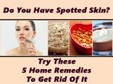 Do You Have Spotted Skin? Try These 5 Home Remedies To Get Rid Of It