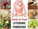 Eat These Foods & Say Goodbye To Uterine Fibroids