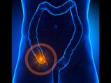 7 Warning Signs That Your Appendix Could Burst!
