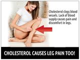 Cholesterol Causes Leg Pain Too! Read This!