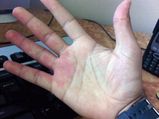 7 Dangerous Reasons Why Your Hands Are Feeling Numb