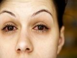 Monsoon Maladies: How To Prevent Redness & Swelling Of Eyes