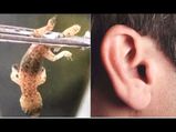 Disturbing Fact: Lizard Found In Man's Ear & Its Tail Is Missing!