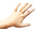 Why A Bump On Your Wrist Is A Cause For Concern