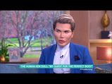 Human Ken Doll Shared His Pictures Before 58 Surgeries