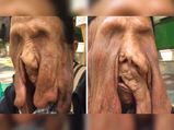 Granny With A Melting Face Refuses To Undergo A Surgery!