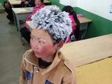 Real Life Story: What Happened To The “Frost Boy” Of China