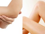 Say Goodbye To Dark Elbows And Knees With These Remedies