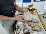 This Is India's First Ever Human Brain Museum