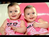 Monochorionic Monoamniotic (MoMo) Twins: Diagnosis, Complications And Treatment
