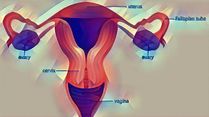 Endometrial Cancer: Causes, Symptoms, Diagnosis And Treatment
