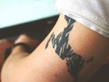 Tattoo Removal Methods: Types & Risks