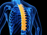 Kyphosis: Causes, Symptoms, Diagnosis & Treatment