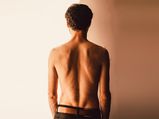 Scoliosis - Symptoms, Causes, Diagnosis, Risk Factors And Treatment