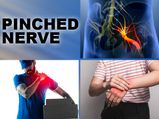 Pinched Nerve: Symptoms, Causes, Diagnosis & Treatment