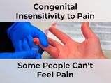 Congenital Insensitivity To Pain (CIP): Causes, Symptoms, Complications, Diagnosis And Treatment