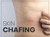 Chafing: Causes, Symptoms, Complications, Treatment & Prevention