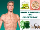 7 Effective Home Remedies For Chickenpox
