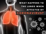 Coronaviurus: What Is Covid-19 Pneumonia? How Does It Affect The Lungs?