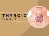 Thyroid Cancer: Causes, Symptoms, Risk Factors, Diagnosis, Treatment And Prevention