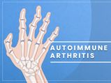 Autoimmune Arthritis: Causes, Types, Symptoms, Diagnosis And Treatment
