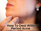 How To Deal With Period Acne: An Exhaustive List Of Solutions