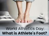 Athlete's Foot: Causes, Symptoms, Diagnosis, Treatment And Prevention