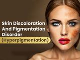 Is Hyperpigmentation A Serious Skin Condition? Know About The Causes, Treatments and Prevention
