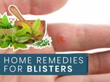 How To Get Rid Of Blisters Naturally? From Coriander Seeds To Ice Cubes