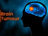 World Brain Tumour Day: Know The Types, Causes, Symptoms, Risk Factors, Diagnosis And Treatment