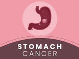 National Cancer Survivors Day (7 June): Stomach Cancer Causes, Symptoms, Treatment And Prevention