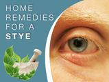 How To Get Rid Of A Stye: Safe And Effective Home Remedies