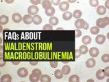 10 FAQs About Waldenstrom Macroglobulinemia (Cancer Of The White Blood Cells)