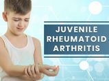 Juvenile Rheumatoid (Idiopathic) Arthritis: Causes, Symptoms, Diagnosis And Treatment