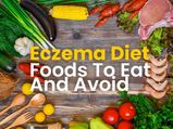 Eczema Diet: What Foods Should You Eat And Avoid