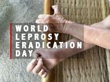 World Leprosy Eradication Day 2021: Types, Causes, Diagnosis & Treatment