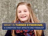 Turner Syndrome: Causes, Symptoms, Complications And Treatments