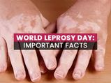 World Leprosy Day 2021: Facts You Might Not Know About Leprosy