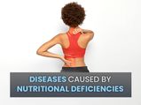 World Health Day 2022: Diseases Caused By Nutritional Deficiencies