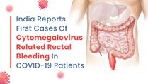 India Reports First Five Cases Of Cytomegalovirus Related Rectal Bleeding In COVID-19 Patients