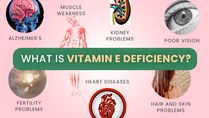 Vitamin E Deficiency: Causes, Symptoms, Complications, Diagnosis And Treatments
