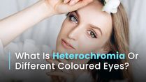 Can The Same Person Have Different Coloured Eyes? Causes, Symptoms And Treatment Of Heterochromia