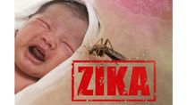 Zika Virus: Infants Exposed To The Virus May Develop Abnormalities In Spite Of Normal Assessment, Reports