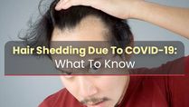 COVID-19: Is Hair Shedding A Common Post-Complication Among The Patients? Causes And Treatments