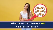 What Are Gallstones Or Cholelithiasis? Causes, Symptoms, Risk Factors, Complications And Treatments