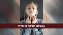 What Is Strep Throat? Causes, Symptoms, Complications, Treatments And Prevention